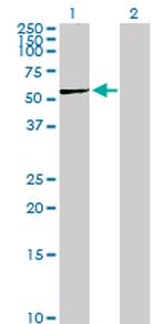 PGD Antibody in Western Blot (WB)