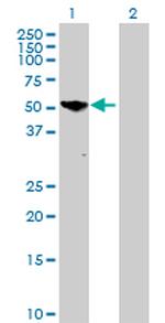 PGM5 Antibody in Western Blot (WB)