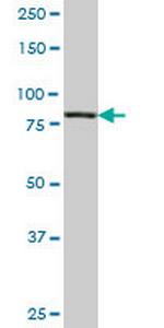 PIK3R1 Antibody in Western Blot (WB)