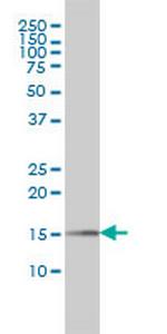 PIN1 Antibody in Western Blot (WB)