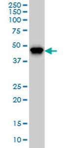 PIP5K2A Antibody in Western Blot (WB)