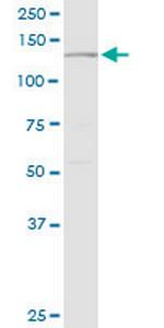 PLCG2 Antibody in Western Blot (WB)