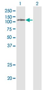 PLD2 Antibody in Western Blot (WB)