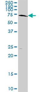 PLK1 Antibody in Western Blot (WB)