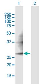 PMM2 Antibody in Western Blot (WB)