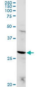 POMC Antibody in Western Blot (WB)