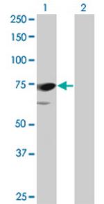 PPEF1 Antibody in Western Blot (WB)