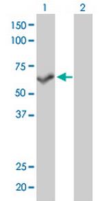 PPP3CB Antibody in Western Blot (WB)