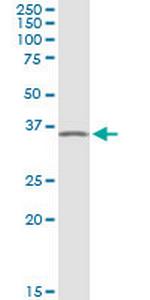 PRKAG1 Antibody in Western Blot (WB)