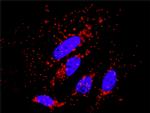 PRKCZ Antibody in Proximity Ligation Assay (PLA) (PLA)