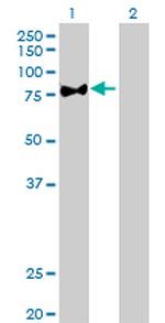 PRKCZ Antibody in Western Blot (WB)