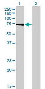 PRKCZ Antibody in Western Blot (WB)