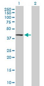 PTPN7 Antibody in Western Blot (WB)