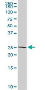 RALB Antibody in Western Blot (WB)