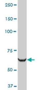 RARS Antibody in Western Blot (WB)