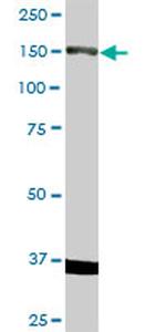 RET Antibody in Western Blot (WB)