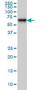 RTKN Antibody in Western Blot (WB)