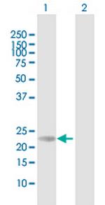 RS1 Antibody in Western Blot (WB)