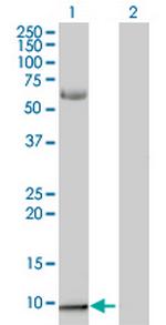 S100A2 Antibody in Western Blot (WB)