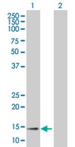 CCL11 Antibody in Western Blot (WB)