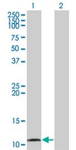 CCL15 Antibody in Western Blot (WB)