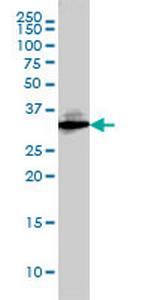 SDCBP Antibody in Western Blot (WB)