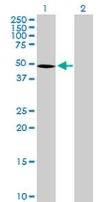 SEMG1 Antibody in Western Blot (WB)
