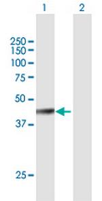 FBXW4 Antibody in Western Blot (WB)