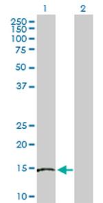 SKP1 Antibody in Western Blot (WB)