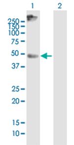 SLC16A1 Antibody in Western Blot (WB)