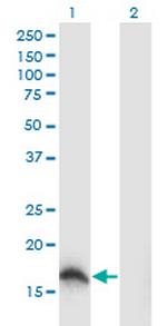 SOD1 Antibody in Western Blot (WB)