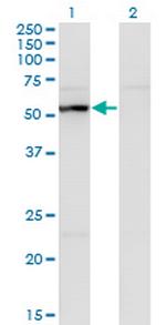 UAP1 Antibody in Western Blot (WB)