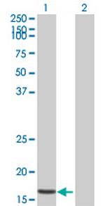 STK10 Antibody in Western Blot (WB)