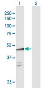 SULT2B1 Antibody in Western Blot (WB)