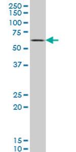 SYN1 Antibody in Western Blot (WB)