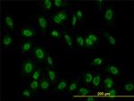 TAF11 Antibody in Immunocytochemistry (ICC/IF)