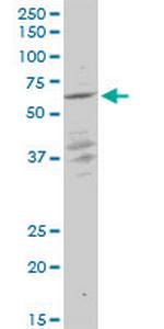 KLF10 Antibody in Western Blot (WB)