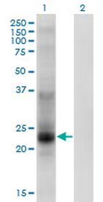 TSPAN8 Antibody in Western Blot (WB)