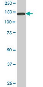 TMEM1 Antibody in Western Blot (WB)