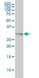 TPM4 Antibody in Western Blot (WB)