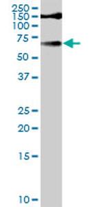 TYR Antibody in Western Blot (WB)