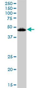 VDR Antibody in Western Blot (WB)