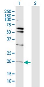 VHL Antibody in Western Blot (WB)