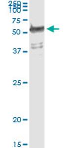 WARS Antibody in Immunoprecipitation (IP)