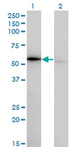 WARS Antibody in Western Blot (WB)