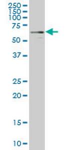 YES1 Antibody in Western Blot (WB)