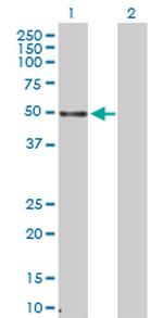 ZFP36 Antibody in Western Blot (WB)