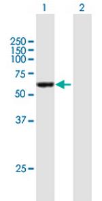 CCDC6 Antibody in Western Blot (WB)