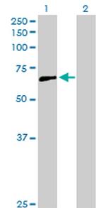 CCDC6 Antibody in Western Blot (WB)