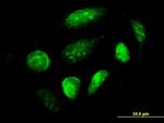 GCM1 Antibody in Immunocytochemistry (ICC/IF)